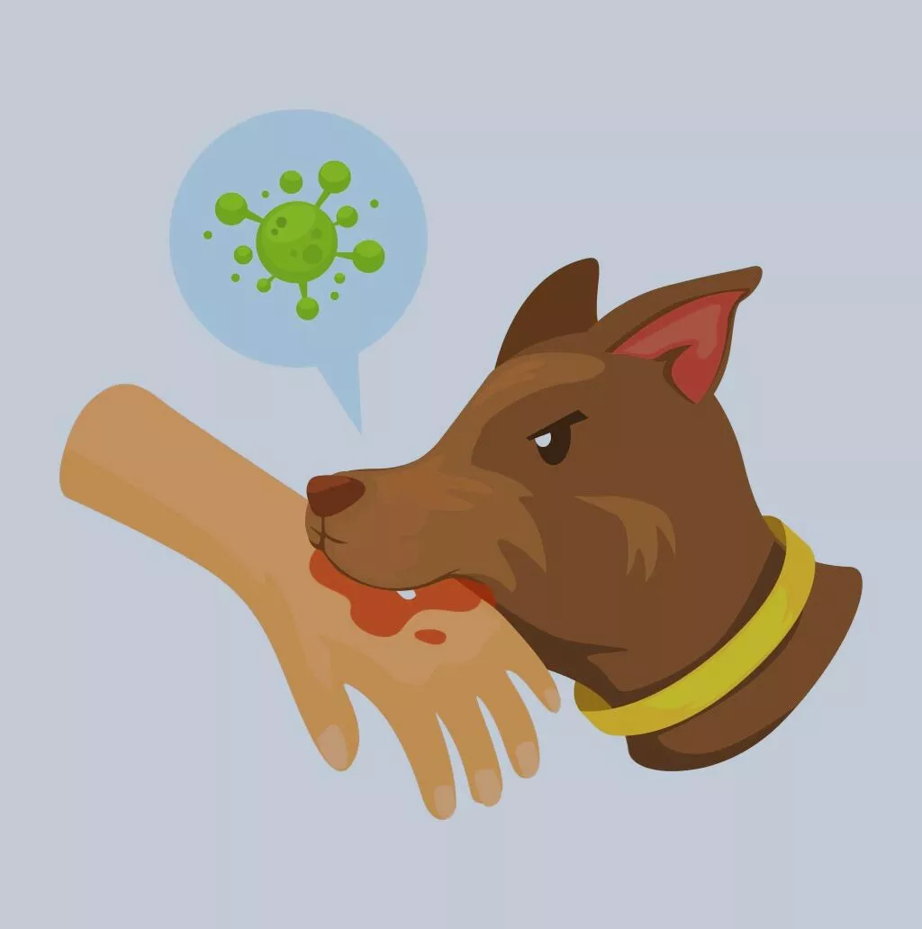 A diagram of a dog biting a person's hand, causing a dog bite infection.