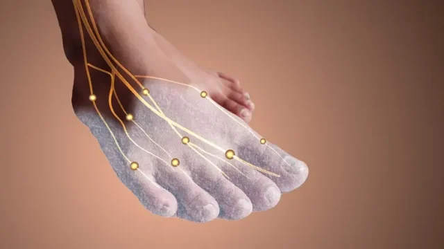 A foot showing tingling sensations, a sign of recovery after a spinal cord injury.