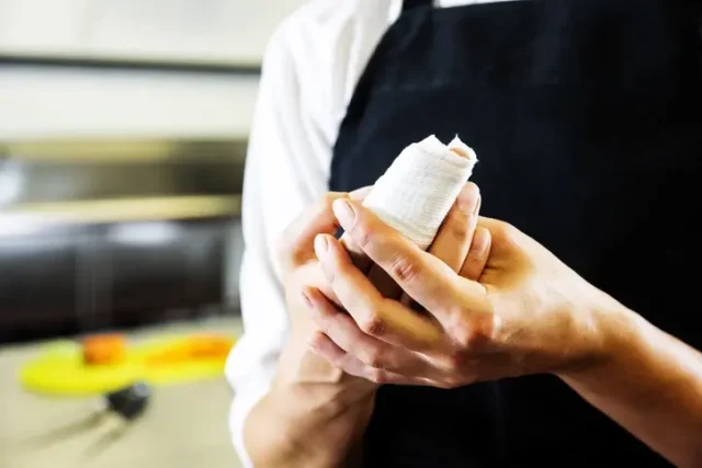 Minor cut on a factory worker's hand after an industrial accident.